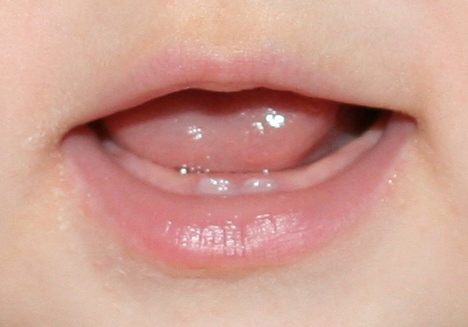 Hazel's chompers